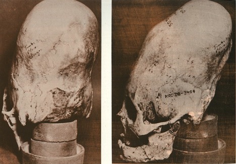 A head binding method and skulls recovered from ancient graves showing the effects of head binding in infancy.